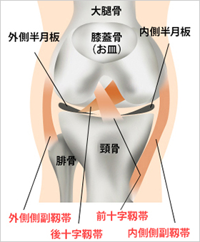 膝の内側側副靭帯の損傷