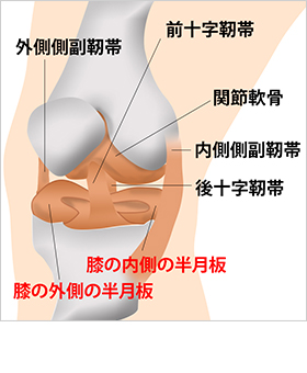 膝の内側半月板の損傷